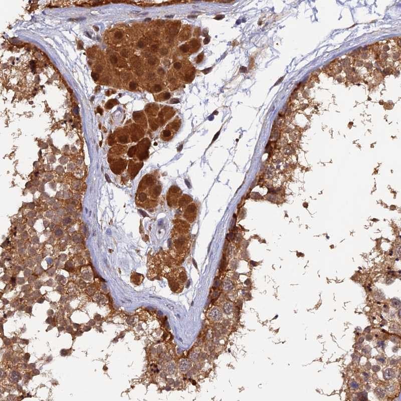 MNS1 Antibody - BSA Free Immunohistochemistry-Paraffin: MNS1 Antibody [NBP1-83763]