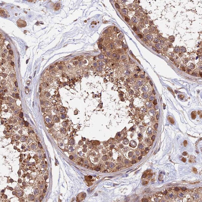 MNS1 Antibody - BSA Free Immunohistochemistry-Paraffin: MNS1 Antibody [NBP1-83764]