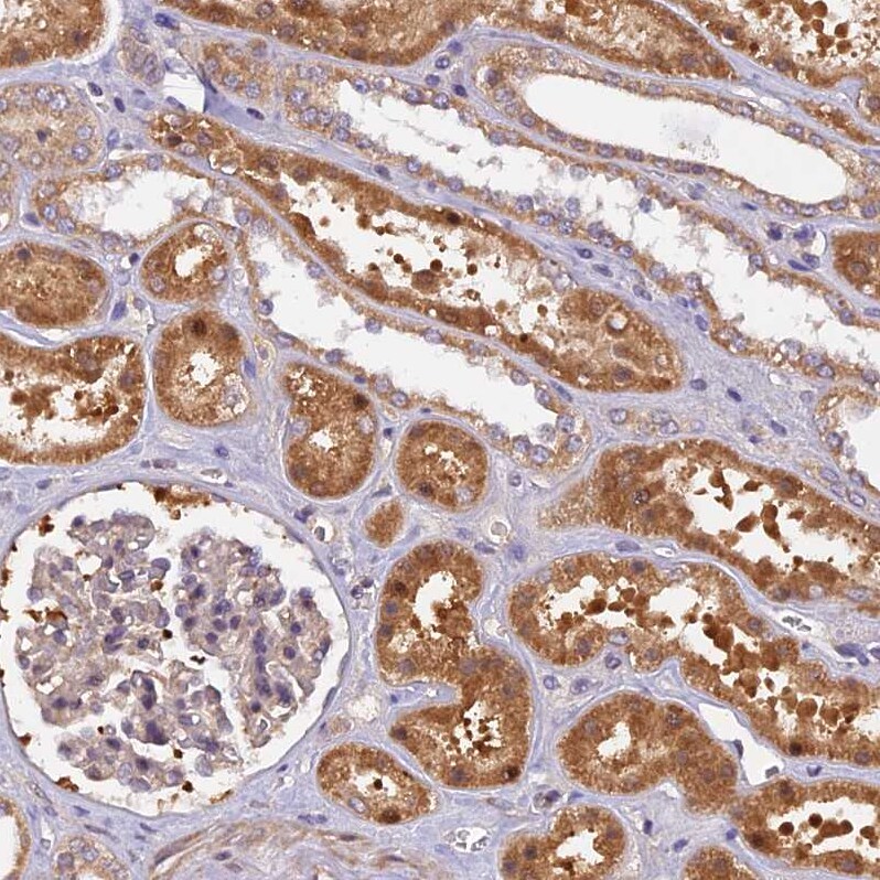 MNS1 Antibody - BSA Free Immunohistochemistry-Paraffin: MNS1 Antibody [NBP1-83764]