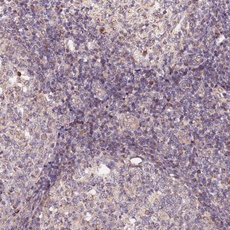 MNS1 Antibody - BSA Free Immunohistochemistry-Paraffin: MNS1 Antibody [NBP1-83764]