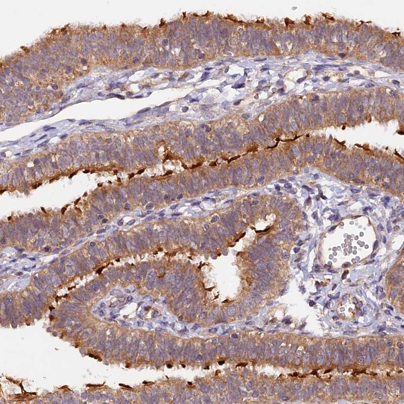 MNS1 Antibody - BSA Free Immunohistochemistry-Paraffin: MNS1 Antibody [NBP1-83764]