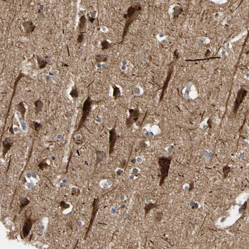 FGD6 Antibody - BSA Free Immunohistochemistry-Paraffin: FGD6 Antibody - BSA Free [NBP1-83770]