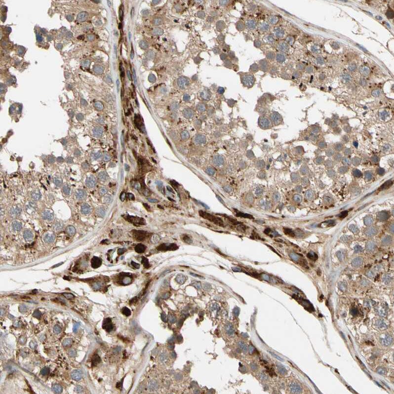 FGD6 Antibody - BSA Free Immunohistochemistry-Paraffin: FGD6 Antibody - BSA Free [NBP1-83770]