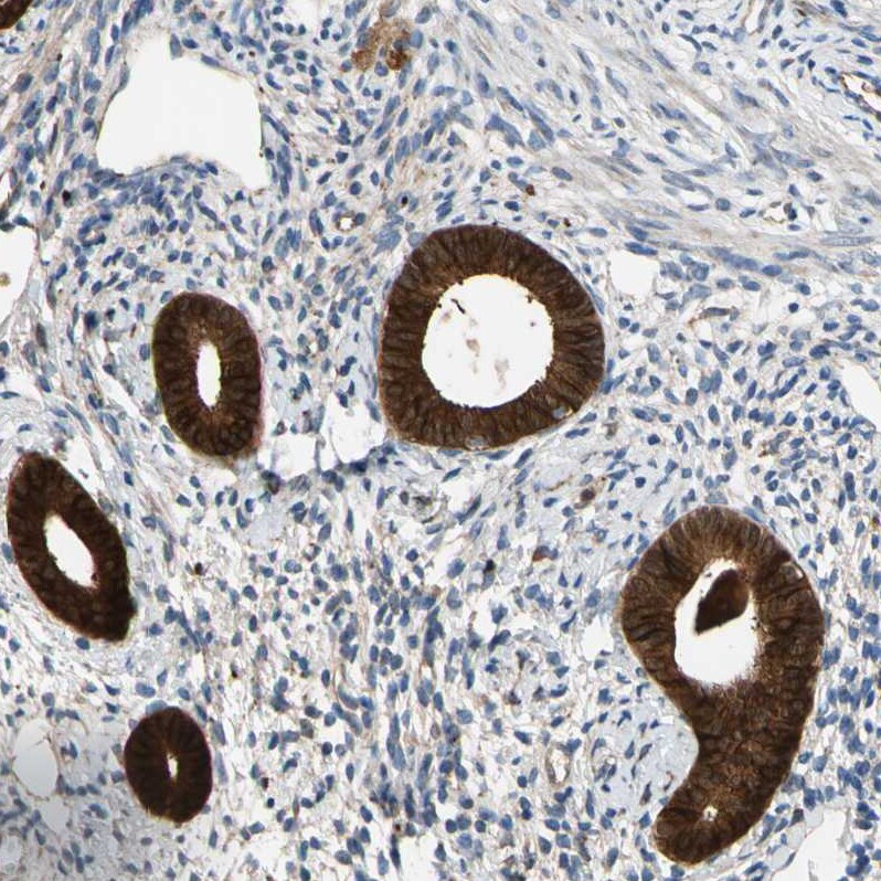 FGD6 Antibody - BSA Free Immunohistochemistry-Paraffin: FGD6 Antibody - BSA Free [NBP1-83770]