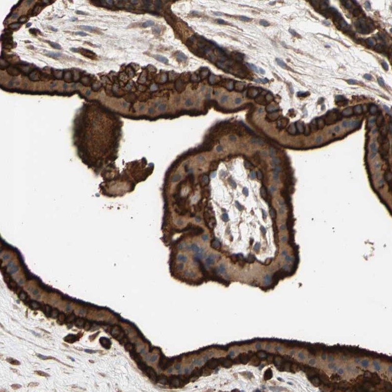 RIOK2 Antibody - BSA Free Immunohistochemistry-Paraffin: RIOK2 Antibody - BSA Free [NBP1-83773]