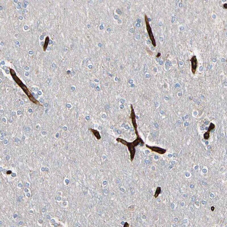 RIOK2 Antibody - BSA Free Immunohistochemistry-Paraffin: RIOK2 Antibody - BSA Free [NBP1-83773]