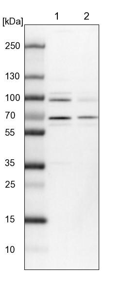PRPF39 Antibody - BSA Free Western Blot: PRPF39 Antibody - BSA Free [NBP1-83774]
