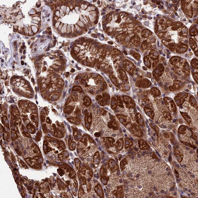 RNF17 Antibody - BSA Free Immunohistochemistry: RNF17 Antibody - BSA Free [NBP1-83782]