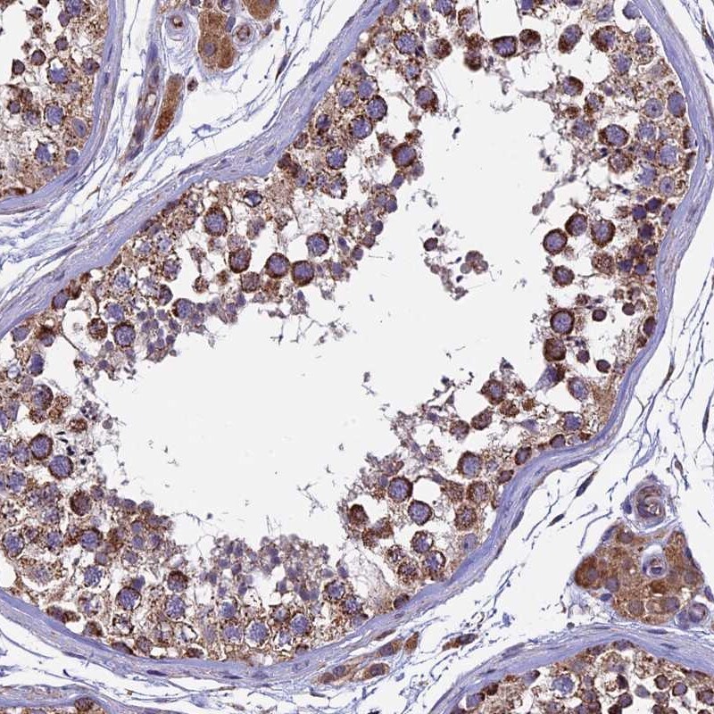 RNF17 Antibody - BSA Free Immunohistochemistry: RNF17 Antibody - BSA Free [NBP1-83783]