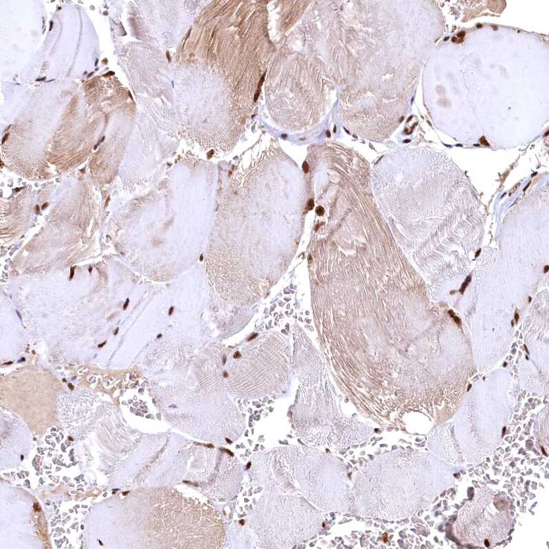 RSRC2 Antibody - BSA Free Immunohistochemistry-Paraffin: RSRC2 Antibody - BSA Free [NBP1-83787]