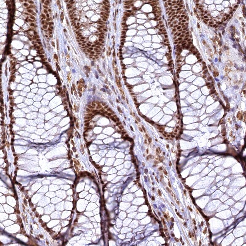 RSRC2 Antibody - BSA Free Immunohistochemistry-Paraffin: RSRC2 Antibody - BSA Free [NBP1-83787]