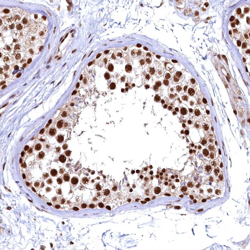 RSRC2 Antibody - BSA Free Immunohistochemistry-Paraffin: RSRC2 Antibody - BSA Free [NBP1-83787]