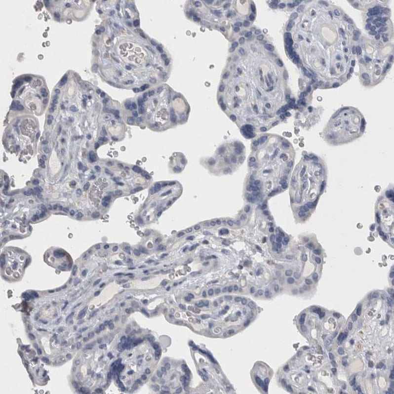 DHRS4 Antibody - BSA Free Immunohistochemistry-Paraffin: DHRS4 Antibody - BSA Free [NBP1-83790]