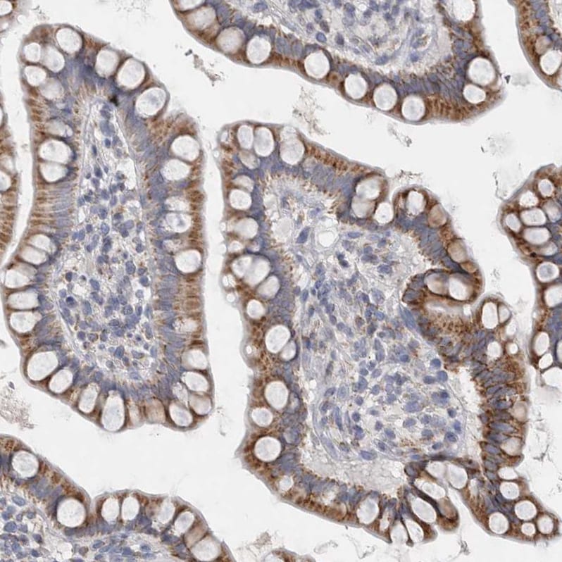 DHRS4 Antibody - BSA Free Immunohistochemistry-Paraffin: DHRS4 Antibody - BSA Free [NBP1-83790]