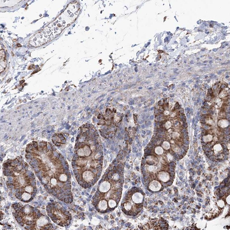 CWF19L1 Antibody - BSA Free Immunohistochemistry-Paraffin: CWF19L1 Antibody - BSA Free [NBP1-83794]