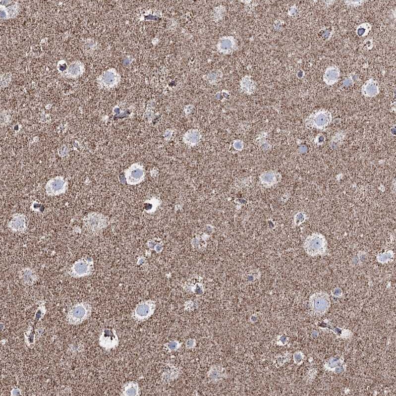 CWF19L1 Antibody - BSA Free Immunohistochemistry-Paraffin: CWF19L1 Antibody - BSA Free [NBP1-83794]