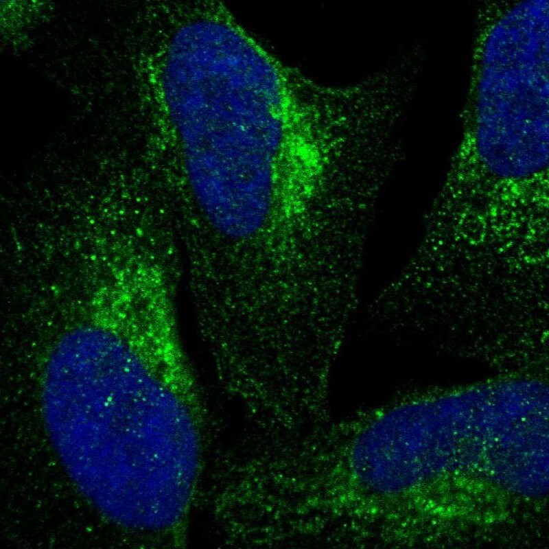 VPS53 Antibody - BSA Free Immunocytochemistry/ Immunofluorescence: VPS53 Antibody [NBP1-83798]