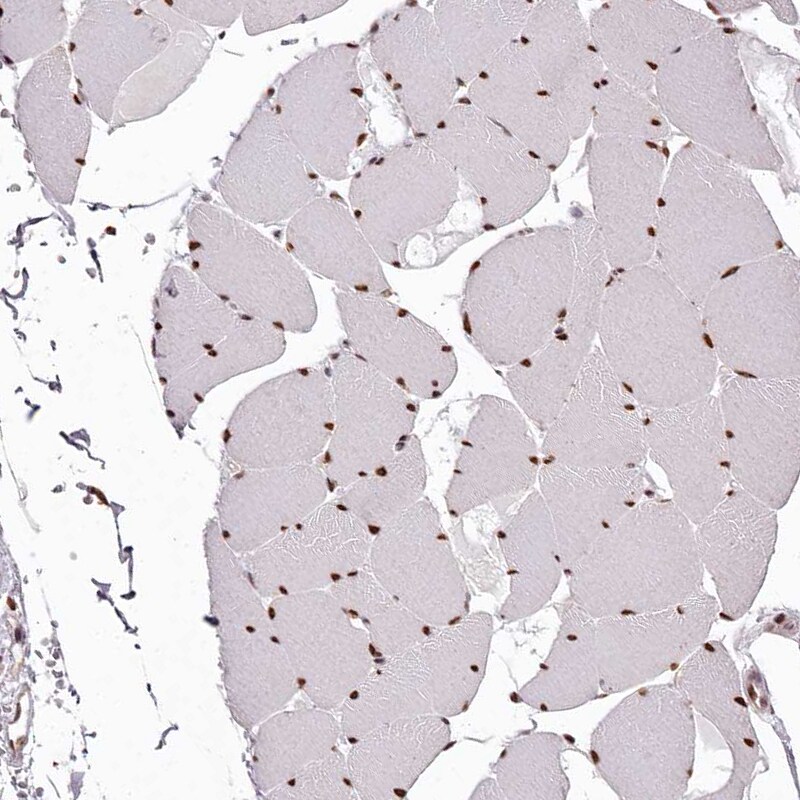 PSPC1 Antibody - BSA Free Immunohistochemistry-Paraffin: PSPC1 Antibody [NBP1-83801]
