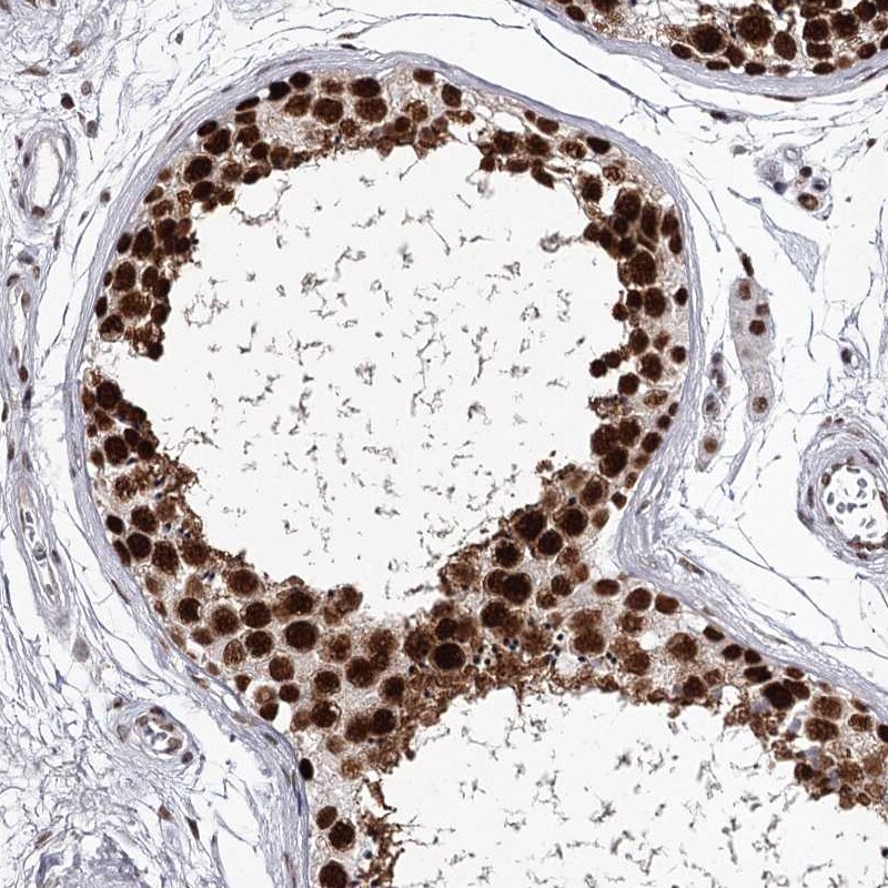 PSPC1 Antibody - BSA Free Immunohistochemistry-Paraffin: PSPC1 Antibody [NBP1-83801]