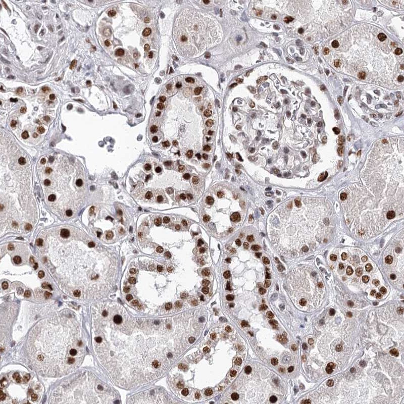 PSPC1 Antibody - BSA Free Immunohistochemistry-Paraffin: PSPC1 Antibody [NBP1-83801]