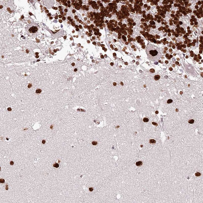PSPC1 Antibody - BSA Free Immunohistochemistry-Paraffin: PSPC1 Antibody [NBP1-83801]