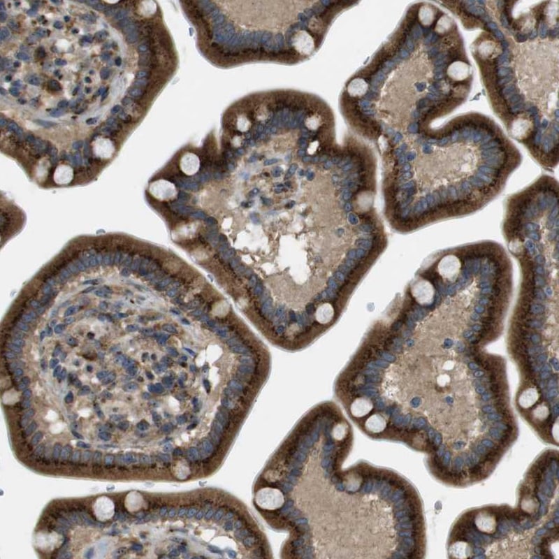 TMEM143 Antibody - BSA Free Immunohistochemistry-Paraffin: TMEM143 Antibody - BSA Free [NBP1-83809]
