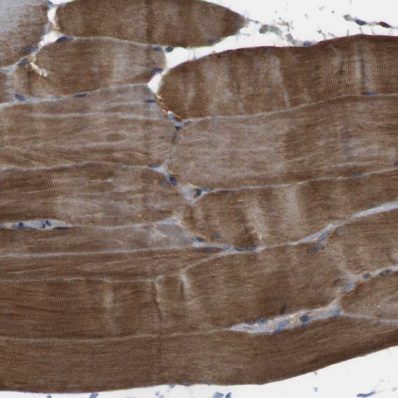 TMEM143 Antibody - BSA Free Immunohistochemistry-Paraffin: TMEM143 Antibody - BSA Free [NBP1-83809]