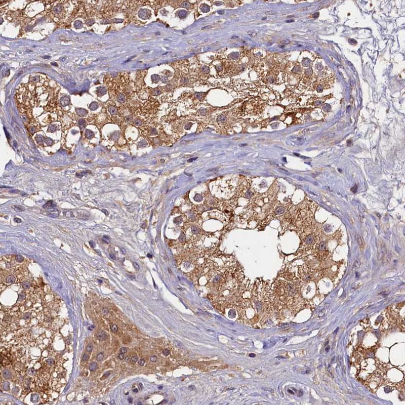 TMEM39A Antibody - BSA Free Immunohistochemistry-Paraffin: TMEM39A Antibody [NBP1-83813]