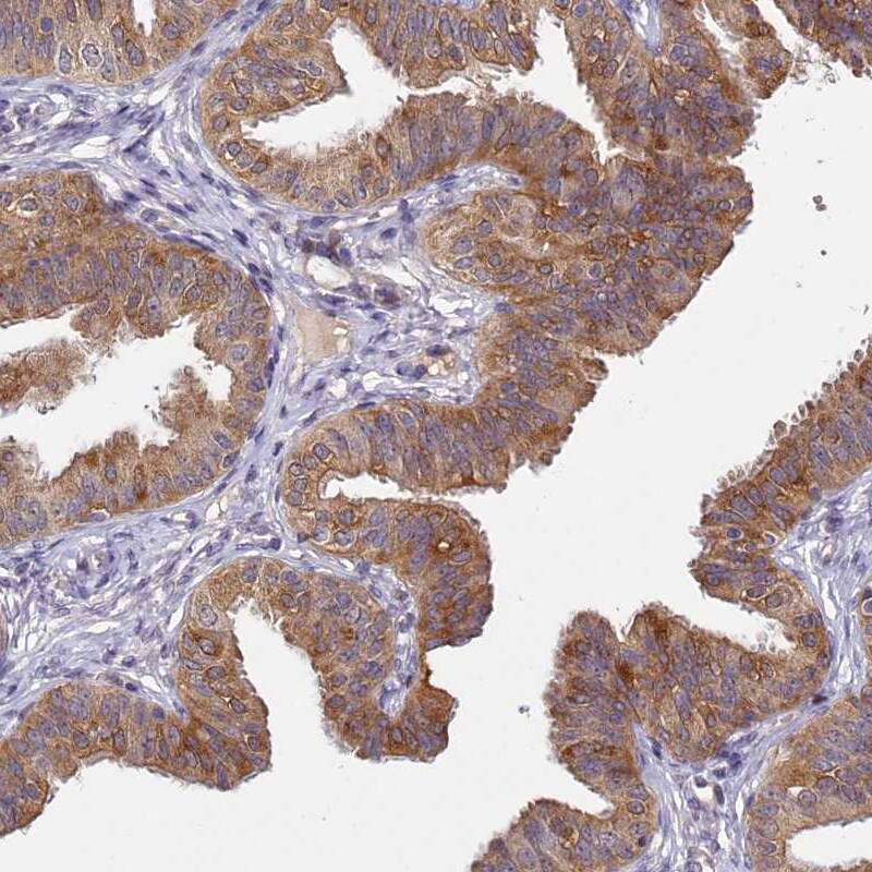 TMEM39A Antibody - BSA Free Immunohistochemistry-Paraffin: TMEM39A Antibody [NBP1-83813]
