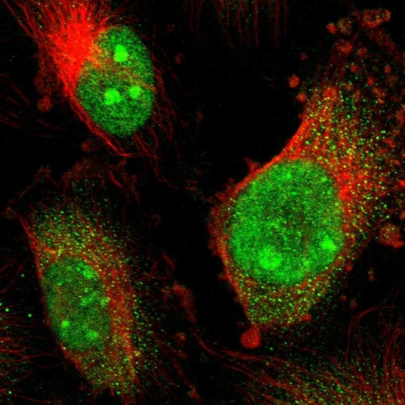 CoREST3/RCOR3 Antibody - BSA Free Immunocytochemistry/ Immunofluorescence: CoREST3/RCOR3 Antibody [NBP1-83820]