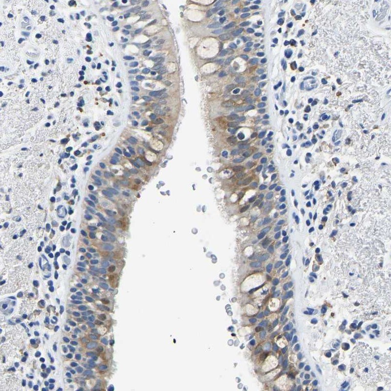 ZDHHC13 Antibody - BSA Free Immunohistochemistry-Paraffin: ZDHHC13 Antibody [NBP1-83822]