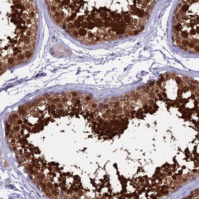 IGSF6/DORA Antibody Immunohistochemistry-Paraffin: IGSF6/DORA Antibody [NBP1-84060]