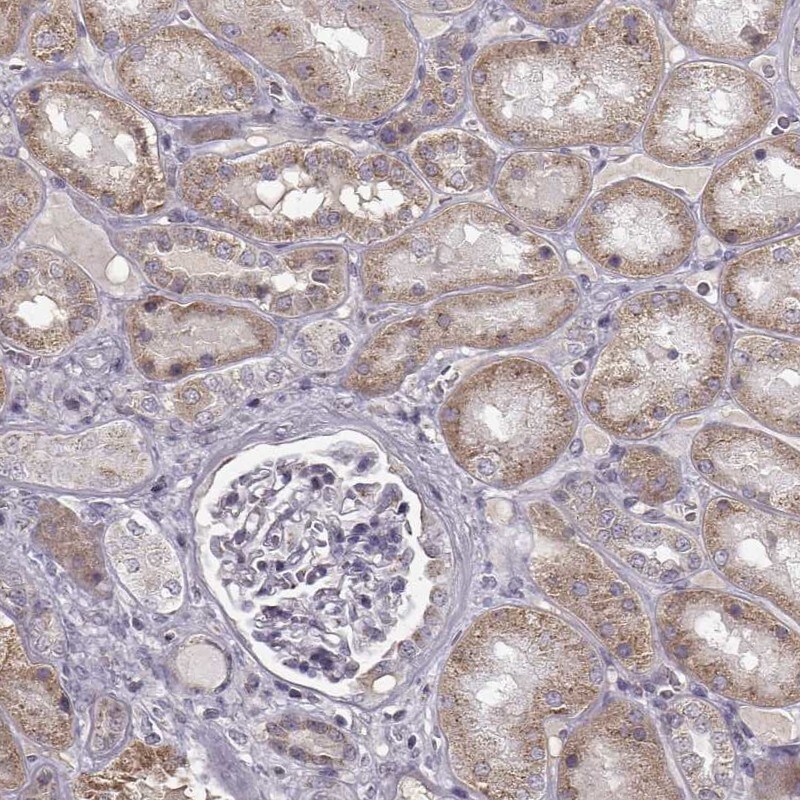 SLC4A5 Antibody Immunohistochemistry-Paraffin: ZCCHC8 Antibody [NBP1-82595]