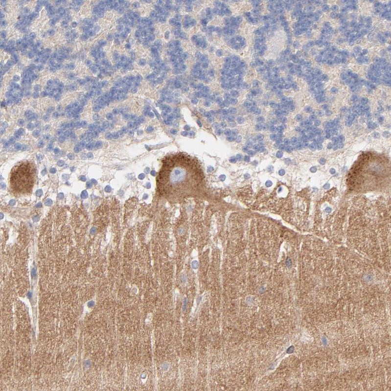 Septin-11 Antibody Immunohistochemistry-Paraffin: Septin-11 Antibody [NBP1-83824]