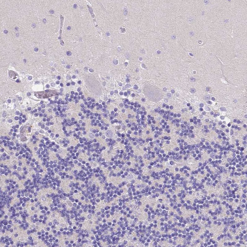 BTN1A1/Butyrophilin Antibody Immunohistochemistry-Paraffin: BTN1A1/Butyrophilin Antibody [NBP1-88503]