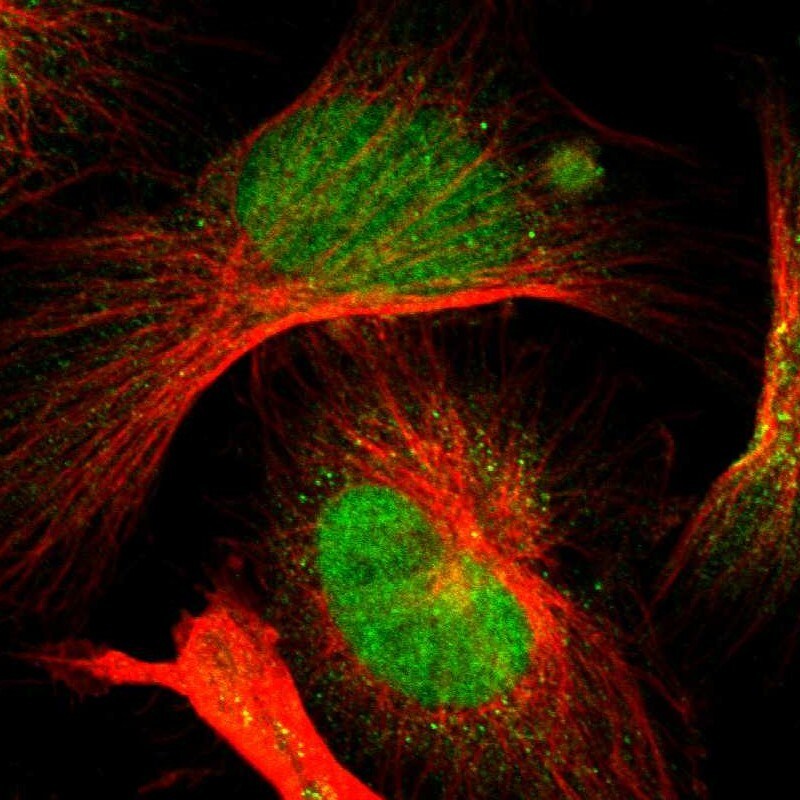 OGFOD1 Antibody - BSA Free Immunocytochemistry/ Immunofluorescence: OGFOD1 Antibody [NBP1-83826]