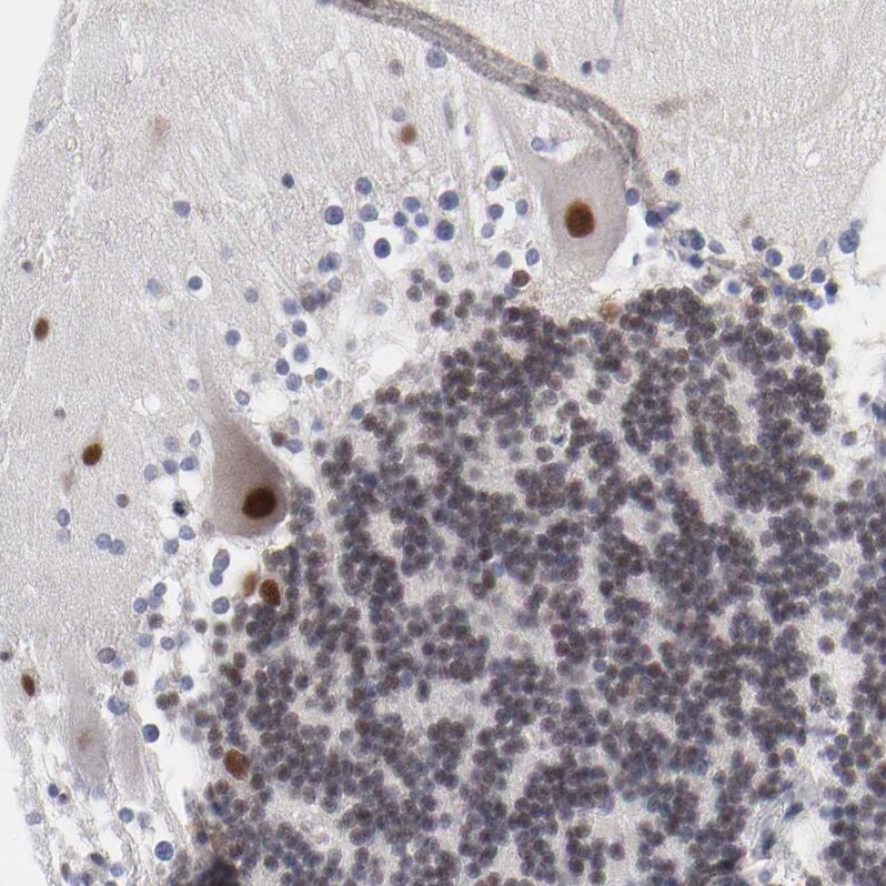 OGFOD1 Antibody - BSA Free Immunohistochemistry-Paraffin: OGFOD1 Antibody - BSA Free [NBP1-83826]