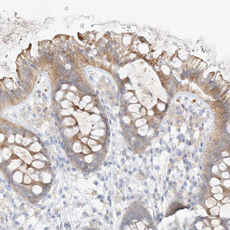 ZZEF1 Antibody - BSA Free Immunohistochemistry-Paraffin: ZZEF1 Antibody - BSA Free [NBP1-83827]