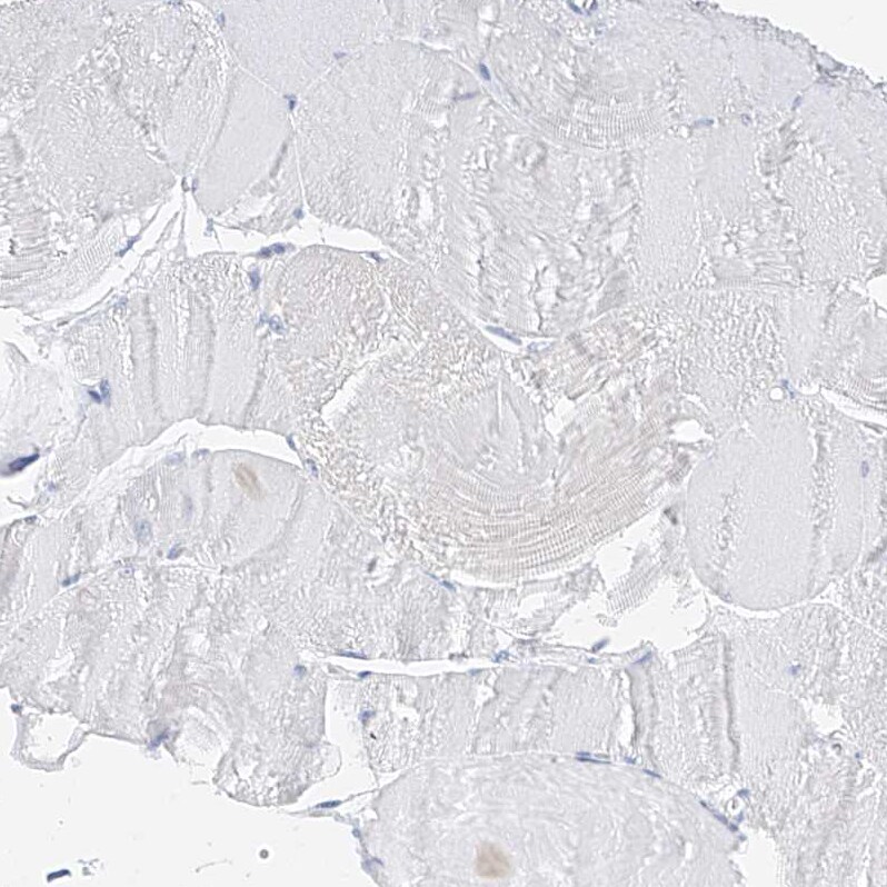 ZZEF1 Antibody - BSA Free Immunohistochemistry-Paraffin: ZZEF1 Antibody [NBP1-83828]