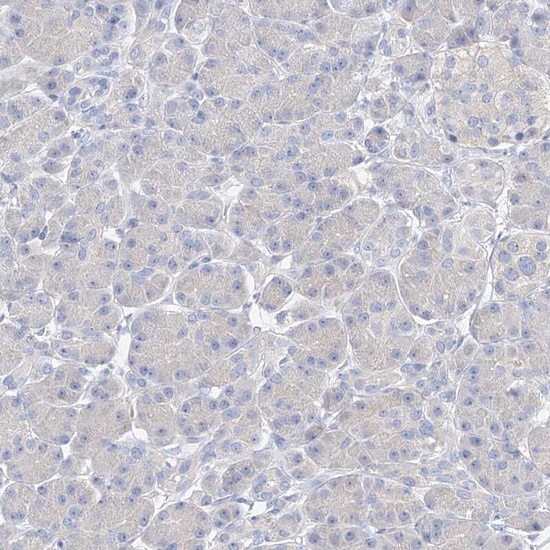 ZZEF1 Antibody - BSA Free Immunohistochemistry-Paraffin: ZZEF1 Antibody [NBP1-83828]