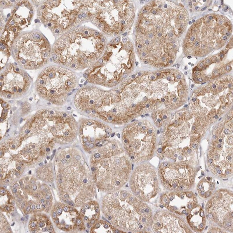 PANK4 Antibody - BSA Free Immunohistochemistry-Paraffin: PANK4 Antibody - BSA Free [NBP1-83832]