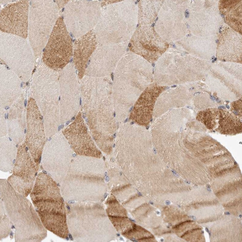 PANK4 Antibody - BSA Free Immunohistochemistry-Paraffin: PANK4 Antibody - BSA Free [NBP1-83832]