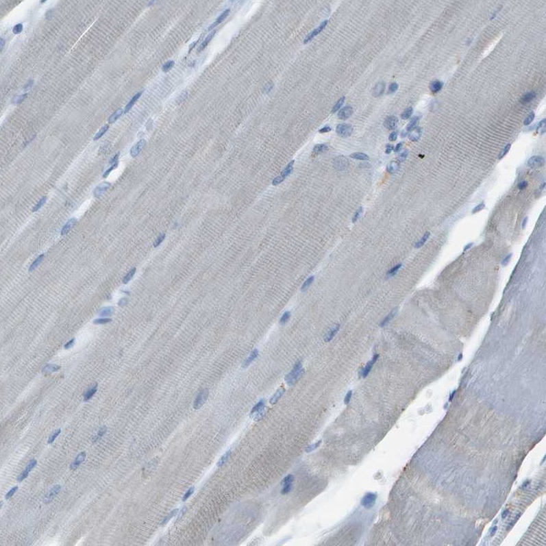 LGI2 Antibody - BSA Free Immunohistochemistry-Paraffin: LGI2 Antibody - BSA Free [NBP1-83839]