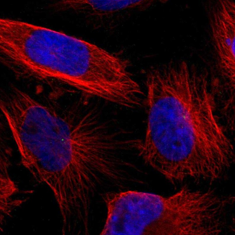 LGI2 Antibody - BSA Free Immunocytochemistry/ Immunofluorescence: LGI2 Antibody - BSA Free [NBP1-83839]