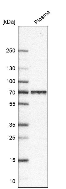 LGI2 Antibody - BSA Free Western Blot: LGI2 Antibody - BSA Free [NBP1-83839]