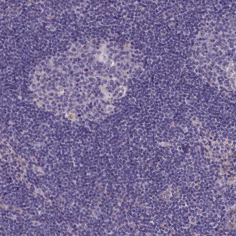 PLEKHG6 Antibody - BSA Free Immunohistochemistry-Paraffin: PLEKHG6 Antibody - BSA Free [NBP1-83840]