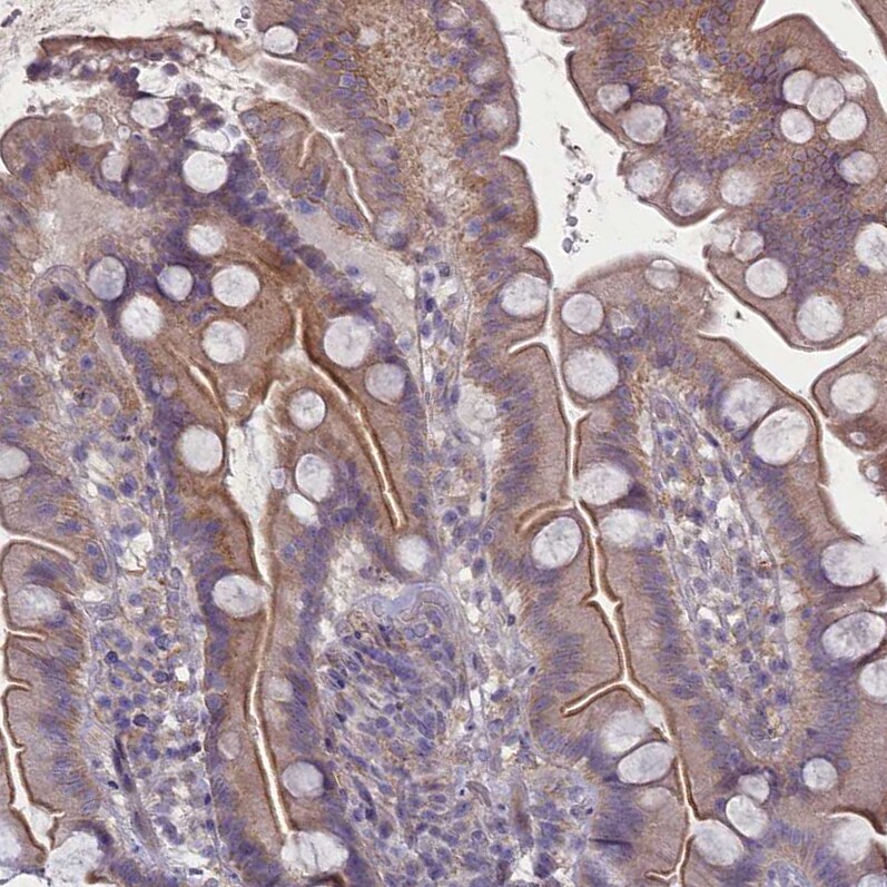 PLEKHG6 Antibody - BSA Free Immunohistochemistry-Paraffin: PLEKHG6 Antibody - BSA Free [NBP1-83840]