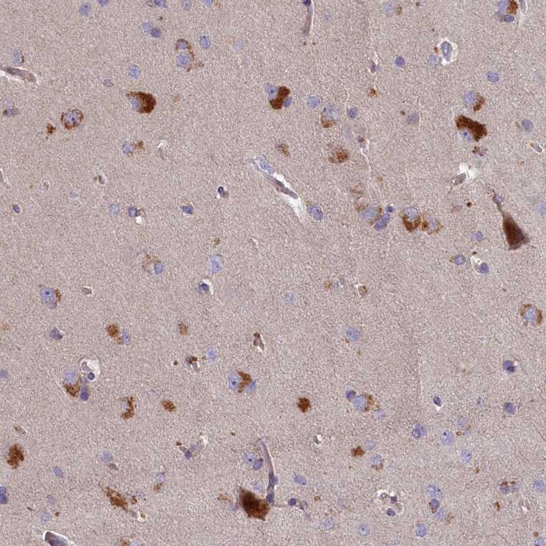 PLEKHG6 Antibody - BSA Free Immunohistochemistry-Paraffin: PLEKHG6 Antibody - BSA Free [NBP1-83840]