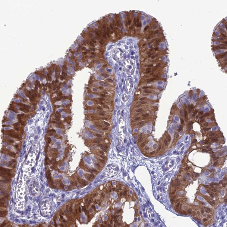 GNPNAT1 Antibody - BSA Free Immunohistochemistry-Paraffin: GNPNAT1 Antibody - BSA Free [NBP1-83842]
