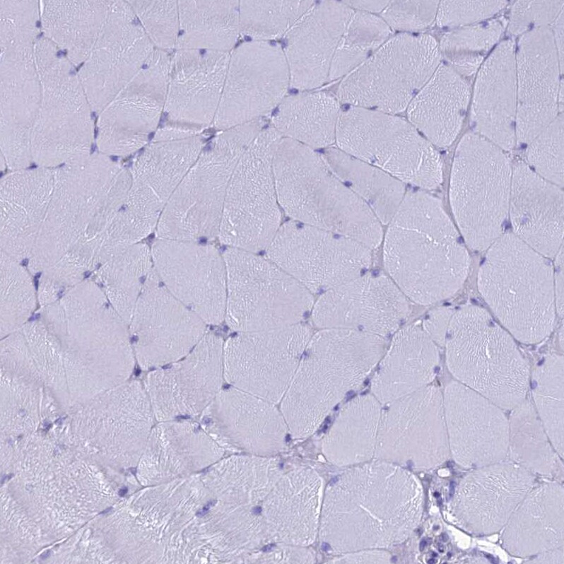 GNPNAT1 Antibody - BSA Free Immunohistochemistry-Paraffin: GNPNAT1 Antibody - BSA Free [NBP1-83842]